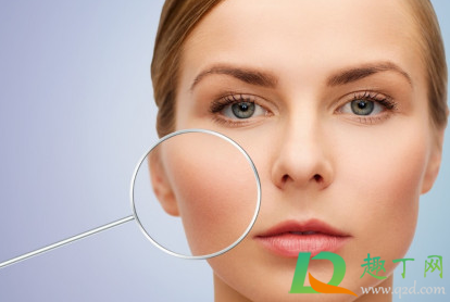 痘印怎么去除效果好(痘印怎么有效去除)