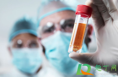 rh(d)血型阳性是什么意思(rh(d血型阳性是什么意思abo血型A)