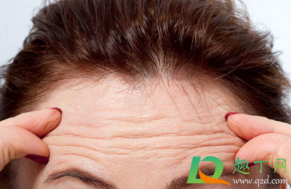 抬头纹怎么去除简单方法(“抬头纹怎么去除”)