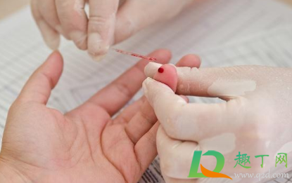 rh(d)血型阳性是什么意思(rh(d血型阳性是什么意思abo血型A)