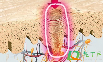 鸡眼怎么去除最好方法脚上(鸡眼怎么去除最好方法脚上六个小方法) 鸡眼怎么去除最好方法脚上(鸡眼怎么去除最好方法脚上六个小方法)
