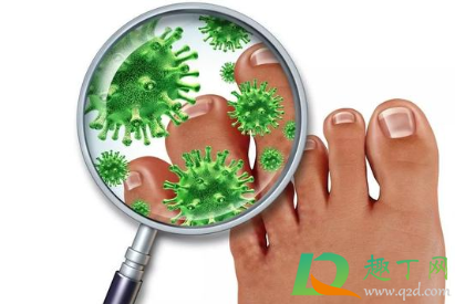 脚上起小水泡很痒是怎么回事还脱皮(脚上起小水泡很痒是怎么回事还脱皮用什么药膏) 脚上起小水泡很痒是怎么回事还脱皮(脚上起小水泡很痒是怎么回事还脱皮用什么药膏)