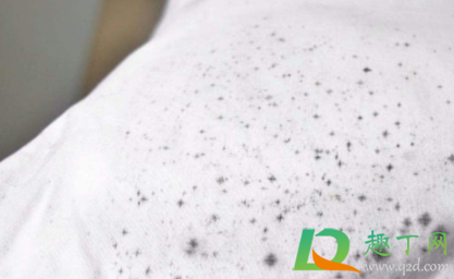 为什么短袖背后全是黑点点(短袖后背有很多小黑点)