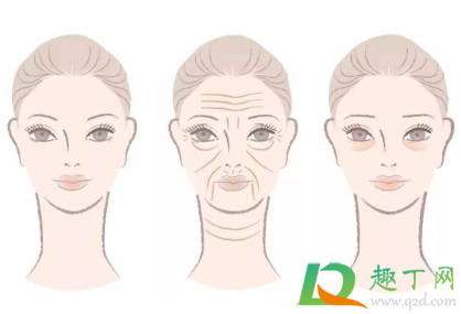 抬头纹怎么去除简单方法(“抬头纹怎么去除”)