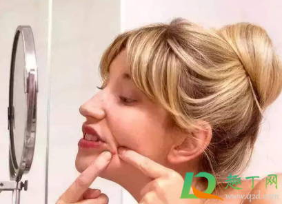 下巴闭口粉刺怎么去除(下巴闭口粉刺怎么可以有效的去除)