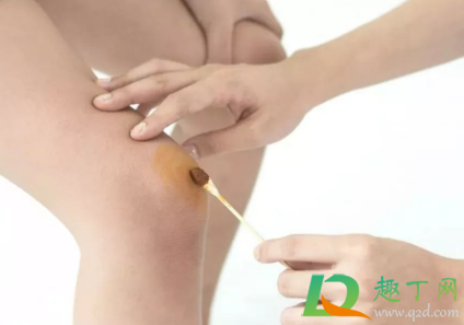 处理伤口用碘酒还是碘伏(伤口愈合用碘伏还是碘酒)