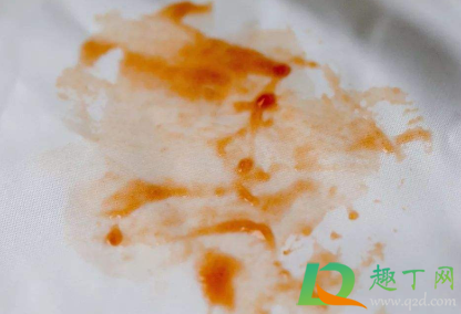 墙上油渍用什么洗得掉(去墙上的油渍) 墙上油渍用什么洗得掉(去墙上的油渍)