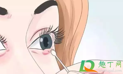 麦粒肿怎么消除快(麦粒肿怎么消除快用什么药如何治疗) 麦粒肿怎么消除快(麦粒肿怎么消除快用什么药如何治疗)