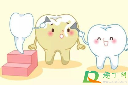 牙结石可以自己抠掉吗(洗牙) 牙结石可以自己抠掉吗(洗牙)