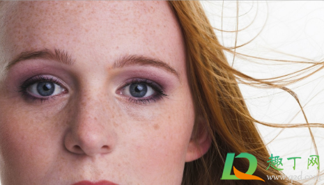 脸上长斑是因为什么原因引起的(熬夜脸上长斑是因为什么原因引起的) 脸上长斑是因为什么原因引起的(熬夜脸上长斑是因为什么原因引起的)