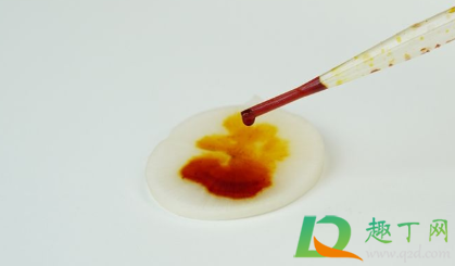 手上碘酒用什么能洗掉(碘酒弄手上洗不掉)