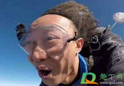 发际线高怎么改善(男生发际线高怎么改善) 发际线高怎么改善(男生发际线高怎么改善)