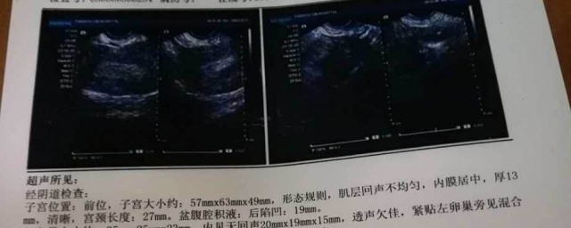 孕妈看过来(我要看孕妇怎么样)