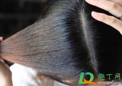 做一次毛囊检测多少钱(做一次毛囊检测大概多少钱)