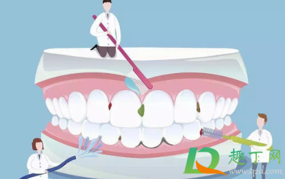 牙结石可以自己抠掉吗(洗牙) 牙结石可以自己抠掉吗(洗牙)