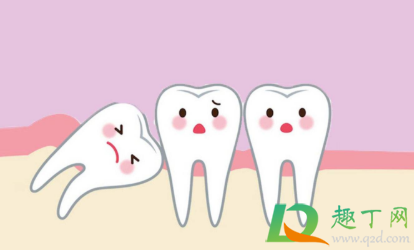 智齿牙龈肿痛怎么快速止疼(智齿引起的牙龈肿痛怎么快速消肿止痛) 智齿牙龈肿痛怎么快速止疼(智齿引起的牙龈肿痛怎么快速消肿止痛)