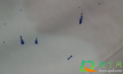 衣物钢笔水怎么去除(怎样能去掉衣服上的钢笔水)