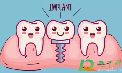 种植牙效果是终身的吗(种植牙可以维持一辈子吗)