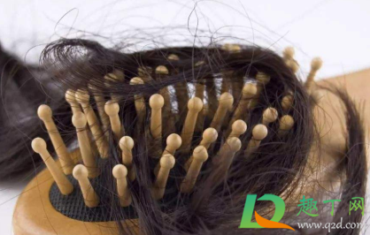 掉头发是什么原因女性(女生掉头发厉害是什么原因引起的)