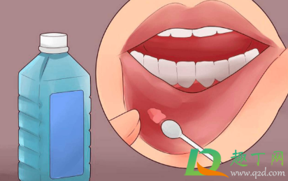 舌头上溃疡怎么治吃维生素(舌头溃疡吃复合维生素可以吗) 舌头上溃疡怎么治吃维生素(舌头溃疡吃复合维生素可以吗)