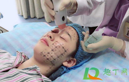 热玛吉五代做一次多少钱(热玛吉五代做一次多少钱一次)