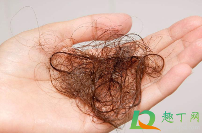 掉头发是什么原因女性(女生掉头发厉害是什么原因引起的)