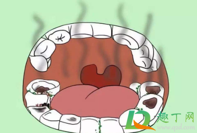 口臭怎么治最有效的方法(口臭怎么治最有效的方法吃什么) 口臭怎么治最有效的方法(口臭怎么治最有效的方法吃什么)