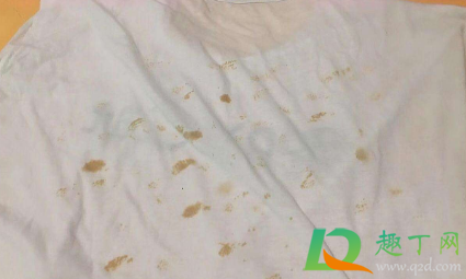 白色衣服有黄斑怎么洗白(白色衣服上面的黄斑怎么洗)