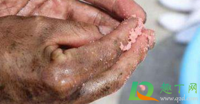 手上弄上柴油怎么去除(手沾到柴油,用什么洗掉) 手上弄上柴油怎么去除(手沾到柴油,用什么洗掉)