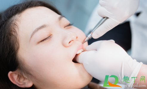 拔智齿后遗症太多了是真的吗(智齿拔了有后遗症吗?) 拔智齿后遗症太多了是真的吗(智齿拔了有后遗症吗?)