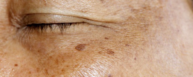 这几个最是安全有效(安全有效性)