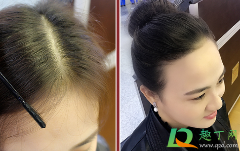 碎发膏用完用洗头吗(碎发膏需要洗吗)