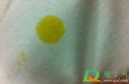 衣服上的油渍怎么洗掉过了几天(衣服上的油渍过了一段时间怎么洗掉) 衣服上的油渍怎么洗掉过了几天(衣服上的油渍过了一段时间怎么洗掉)