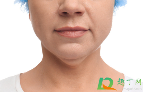 双下巴真的能通过运动瘦吗(双下巴能靠运动减掉吗)