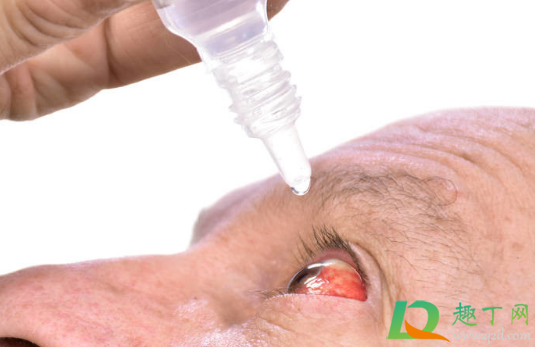 眼睛红血丝是怎么回事(狗狗眼睛红血丝是怎么回事)