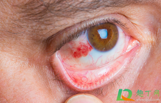 眼睛红血丝是怎么回事(狗狗眼睛红血丝是怎么回事)