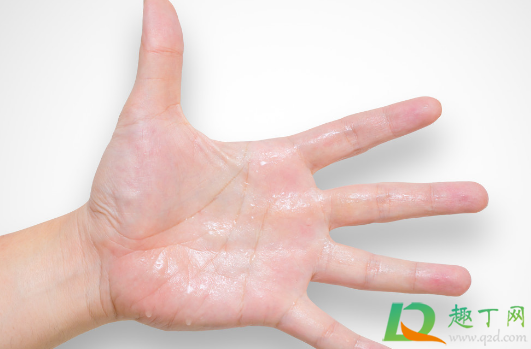 一动就满头大汗是啥虚(怕热一动就满头大汗是啥虚)