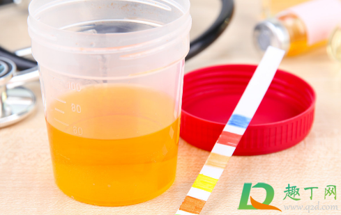 尿液透明像自来水是肾虚吗(尿液是像水那样透明吗) 尿液透明像自来水是肾虚吗(尿液是像水那样透明吗)