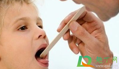 儿童扁桃体切除有什么影响(孩子扁桃体切除有影响吗) 儿童扁桃体切除有什么影响(孩子扁桃体切除有影响吗)