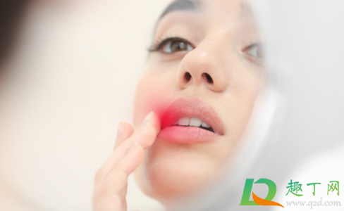 嘴唇上长疱疹怎么办(嘴唇上长疱疹怎么办还流水)