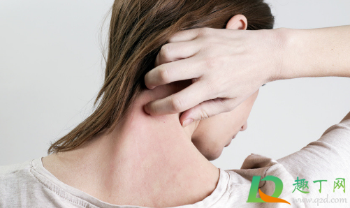 贴膏药处很痒是好还是不好(贴完膏药有点痒是好的还是不好的)