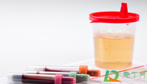 水喝的多尿是透明的正常吗(为什么喝水越多尿液越透明)