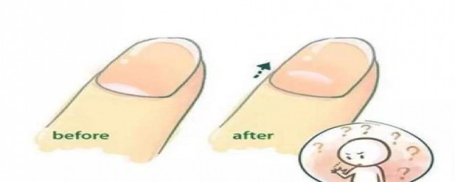 指甲上的月牙是什么(指甲上的月牙是什么东西)