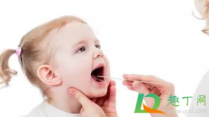 儿童扁桃体切除有什么影响(孩子扁桃体切除有影响吗) 儿童扁桃体切除有什么影响(孩子扁桃体切除有影响吗)