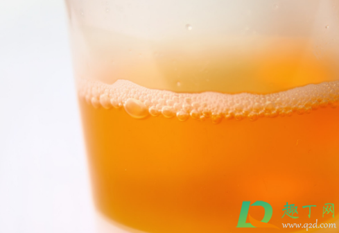 尿液透明像自来水是肾虚吗(尿液是像水那样透明吗)