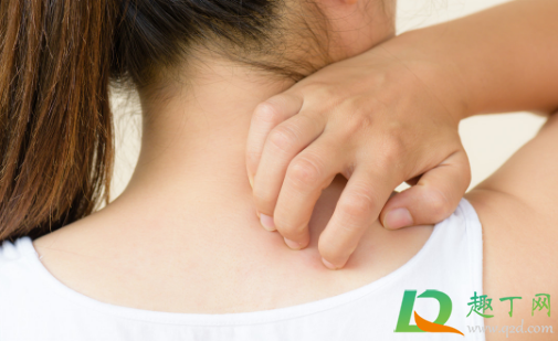 贴膏药处很痒是好还是不好(贴完膏药有点痒是好的还是不好的)