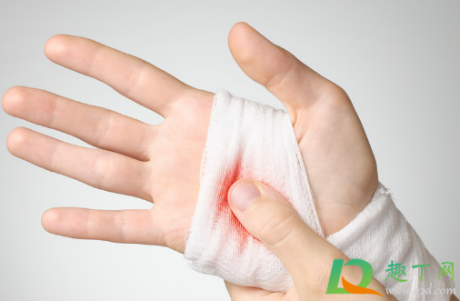 纱布粘肉上会自然脱落么(纱布粘下肉)