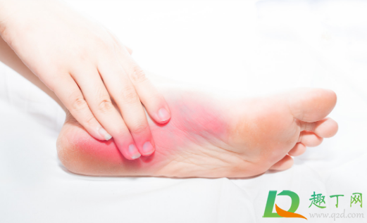 脚心发热能用冷水冰吗(脚心发热可以用冰敷吗)