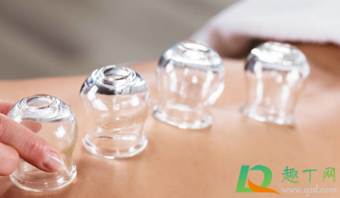 拔罐能去除体内湿气吗(男人拔罐能去除体内湿气吗) 拔罐能去除体内湿气吗(男人拔罐能去除体内湿气吗)