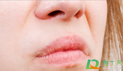 嘴唇干是怎么回事(嘴唇干是怎么回事吃什么药)
